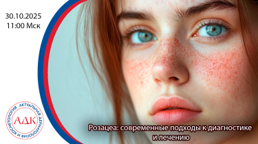Розацеа: современные подходы к диагностике и лечению