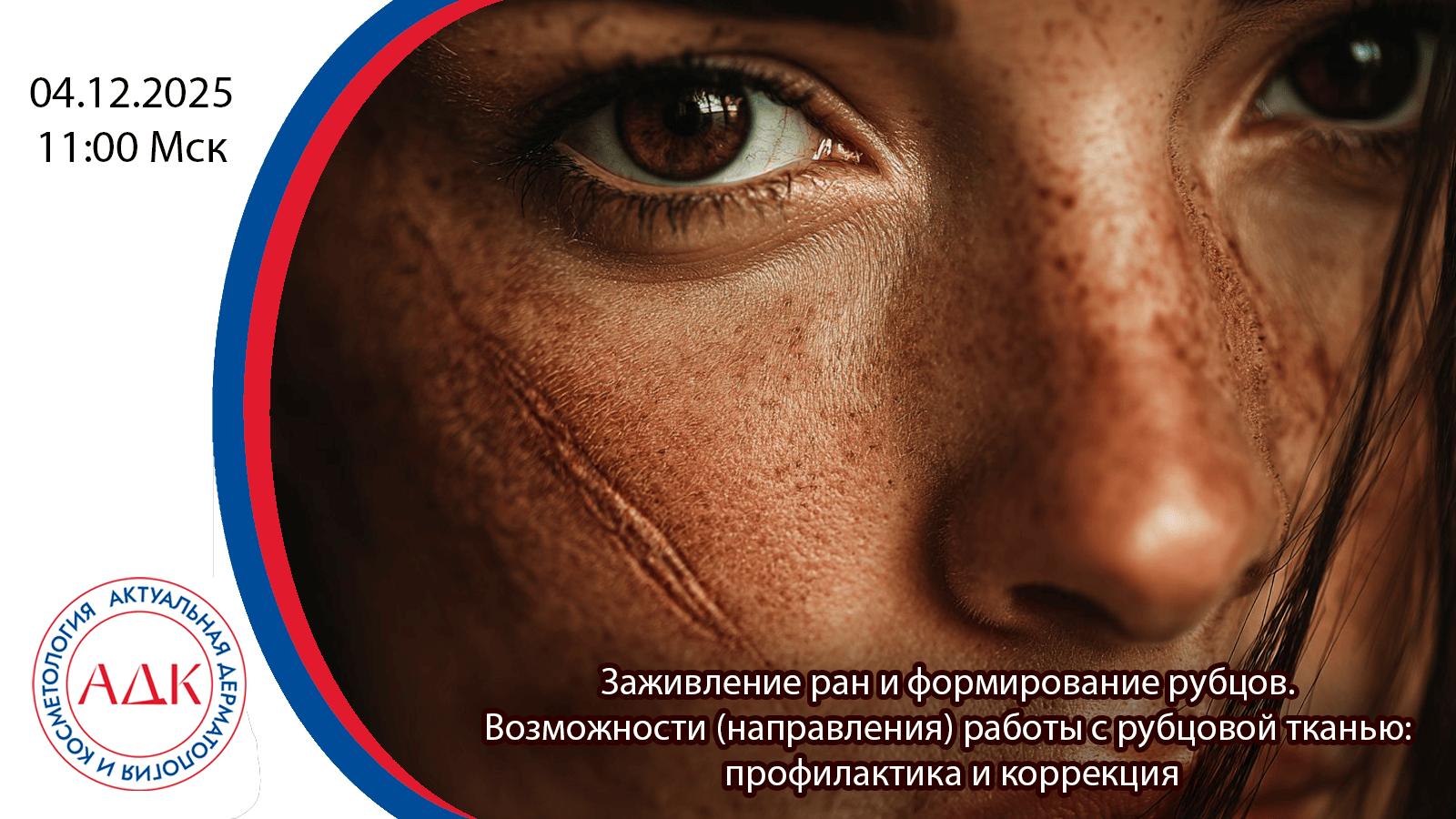 Заживление ран и формирование рубцов. Акцент на профилактику и инъекционные методы