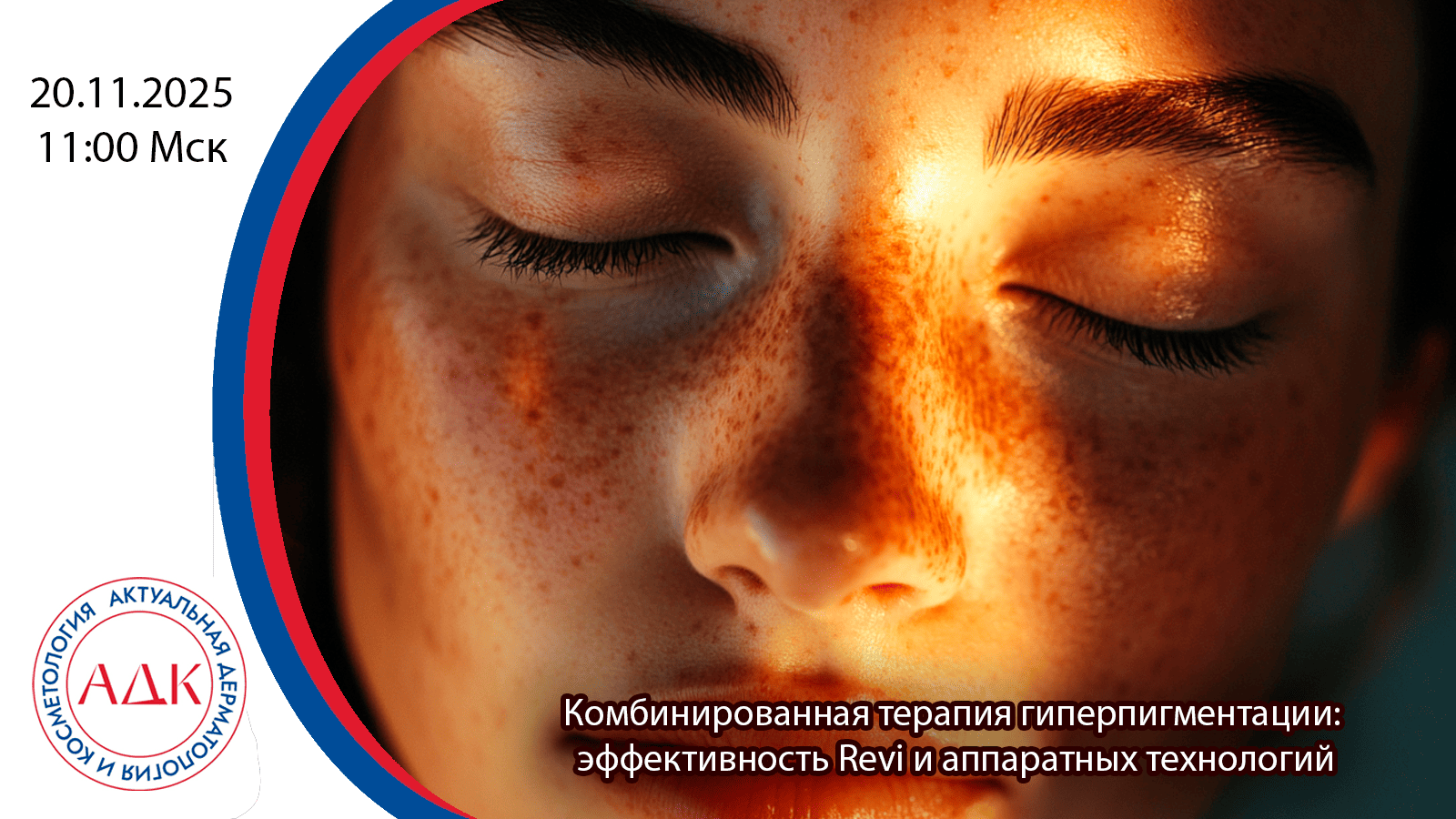 Комбинированная терапия гиперпигментации: эффективность Revi и аппаратных технологий