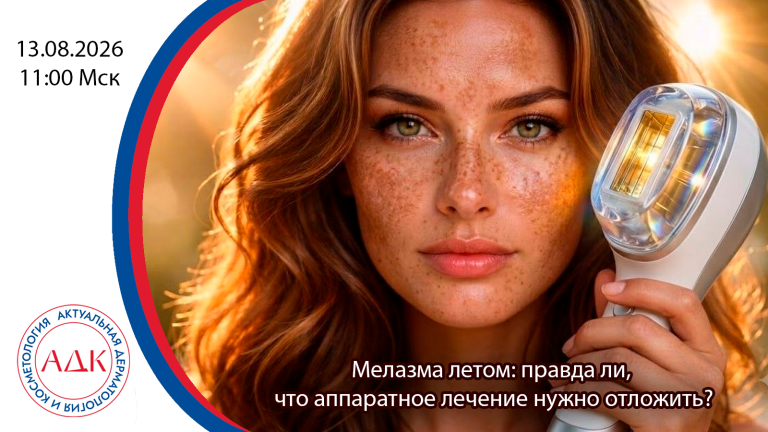 Мелазма летом: правда ли, что аппаратное лечение нужно отложить?